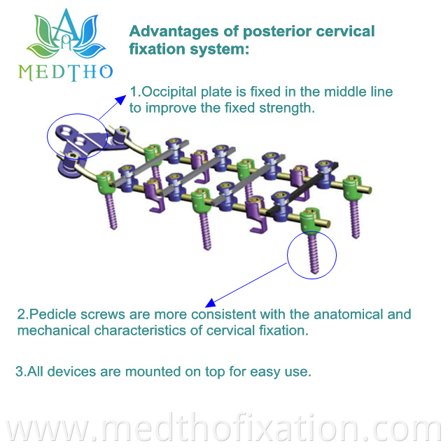 CERVICLE FIXATION